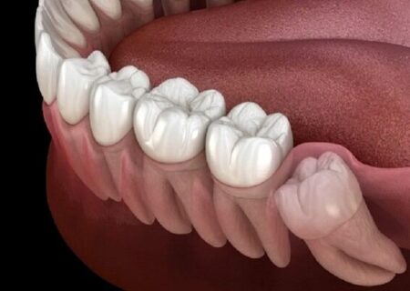 با خواندن این دلیل حتما سراغ مسواک و نخ دندان می‌روید