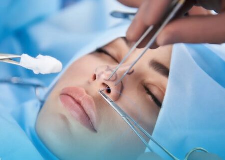 جراحی بینی بدون بیهوشی توسط دستیار دیپلمه پزشک
