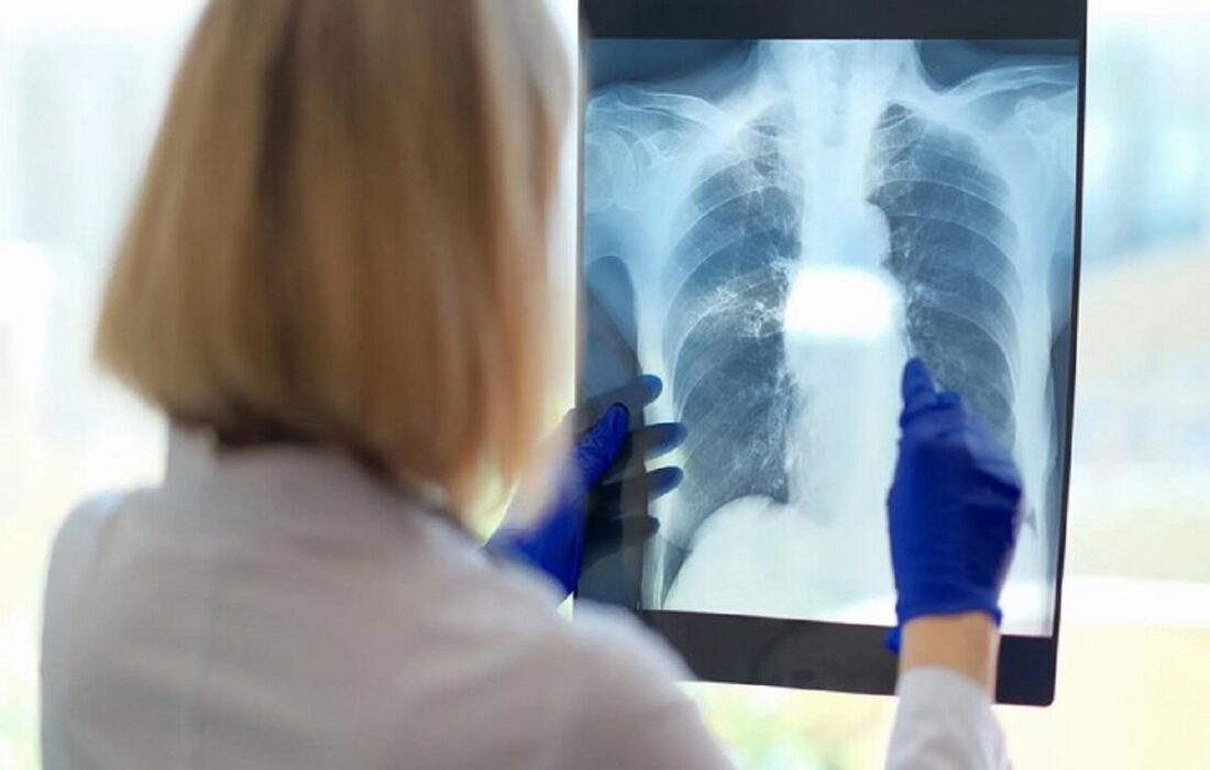 یک علت مهم و کمتر گفته شده درباره خستگی مزمن