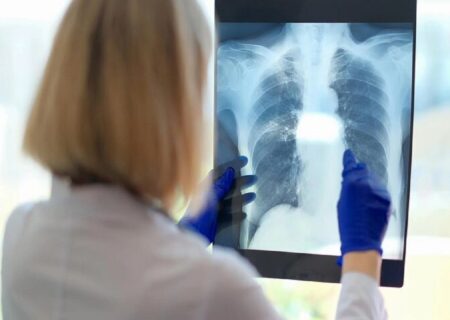 یک علت مهم و کمتر گفته شده درباره خستگی مزمن